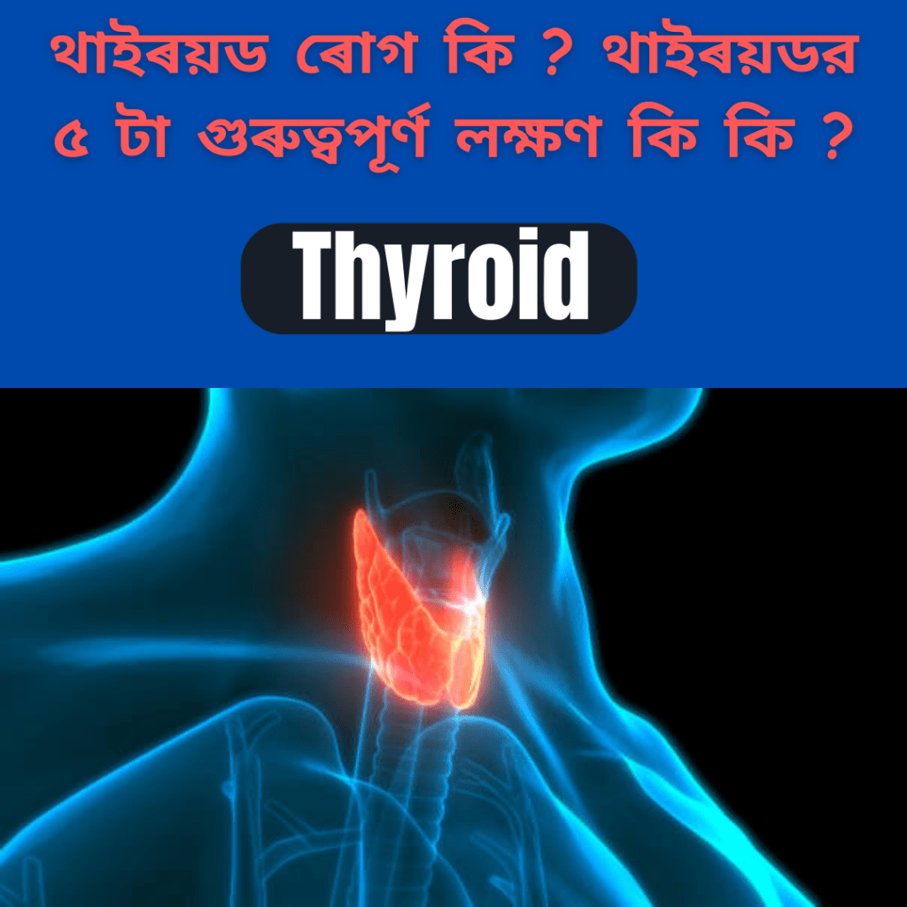 থাইৰয়ড ৰোগ কি ? থাইৰয়ডৰ ৫ টা গুৰুত্বপূৰ্ণ লক্ষণ কি কি ?(What is thyroid dises ? What are thyroid 5 important mrimary symptoms&nbsp;?)